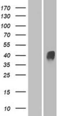 Western Blot: OR4D11 Overexpression Lysate [NBP2-08895]