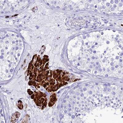 Immunohistochemistry-Paraffin: OR4D5 Antibody [NBP1-92228]