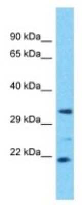 Western Blot: OR4D6 Antibody [NBP3-09783]