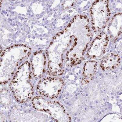 Immunohistochemistry-Paraffin: OR4F3 Antibody [NBP2-54734]