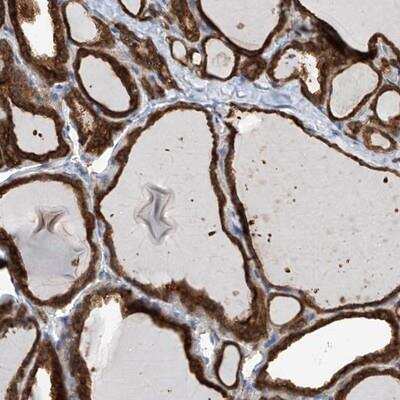 Immunohistochemistry: OR4K1 Antibody [NBP1-86374]