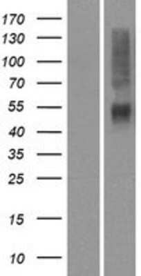 Western Blot: OR4K14 Overexpression Lysate [NBP2-08896]