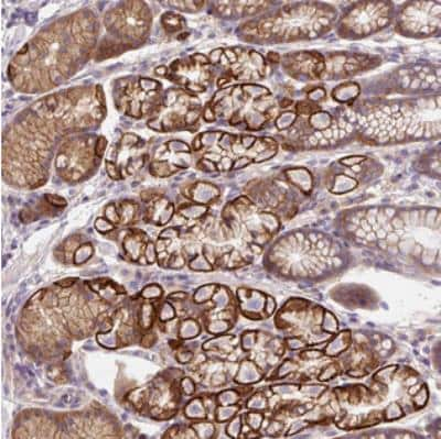 Immunohistochemistry: OR4K15 Antibody [NBP2-30939]