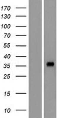 Western Blot: OR4L1 Overexpression Lysate [NBP2-08898]