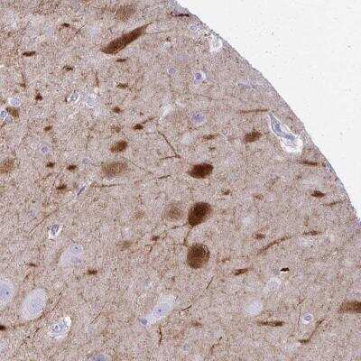 Immunohistochemistry-Paraffin: OR4M1 Antibody [NBP2-46853]