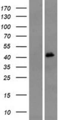 Western Blot: OR4M1 Overexpression Lysate [NBP2-08841]