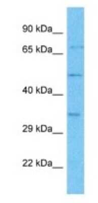 Western Blot: OR4M2 Antibody [NBP3-09677]