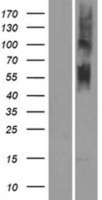 Western Blot: OR4N5 Overexpression Lysate [NBP2-08899]