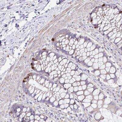 Immunohistochemistry-Paraffin: OR4P4 Antibody [NBP2-32467]