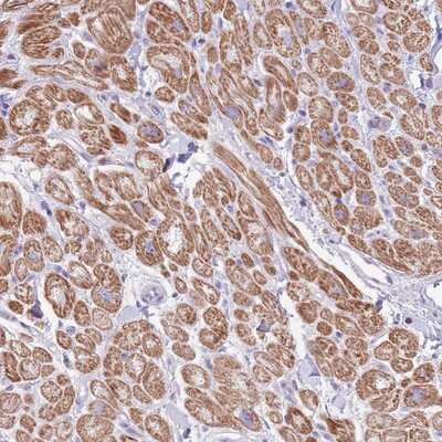 Immunohistochemistry-Paraffin: OR4Q3 Antibody [NBP2-13700]