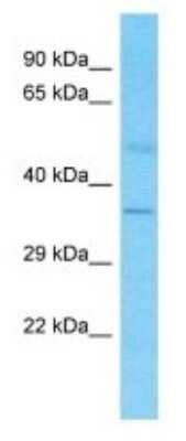 Western Blot: OR4S1 Antibody [NBP3-09789]