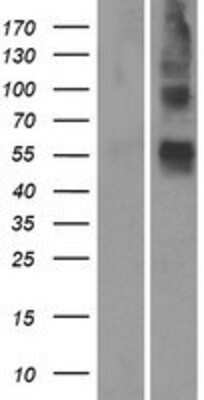 Western Blot: OR4S1 Overexpression Lysate [NBP2-08900]