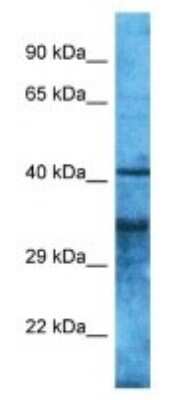 Western Blot: OR4S2 Antibody [NBP3-09658]