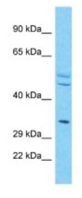 Western Blot: OR4X2 Antibody [NBP3-09790]