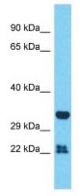 Western Blot: OR51A2 Antibody [NBP3-09861]