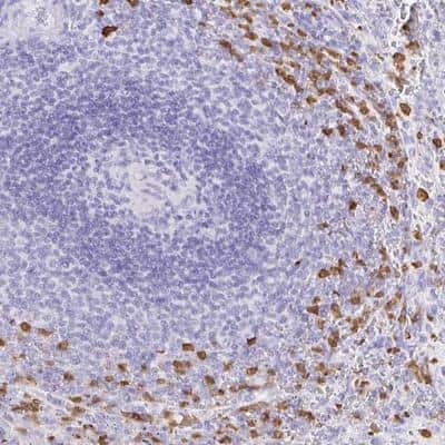 Immunohistochemistry-Paraffin: OR51A7 Antibody [NBP2-32348]