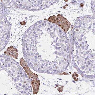 Immunohistochemistry-Paraffin: OR51B5 Antibody [NBP2-32376]