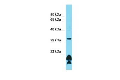 Western Blot: OR51B5 Antibody [NBP2-83322]