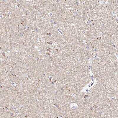 Immunohistochemistry-Paraffin: OR51D1 Antibody [NBP2-32590]