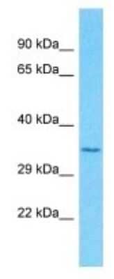 Western Blot: OR51F2 Antibody [NBP3-09862]