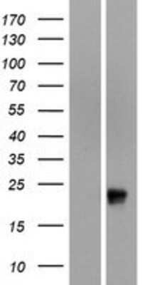 Western Blot: OR51G1 Overexpression Lysate [NBP2-08881]