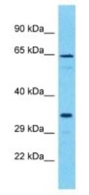 Western Blot: OR51I2 Antibody [NBP3-09863]