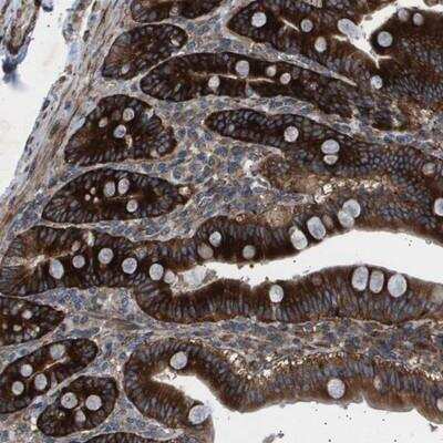 Immunohistochemistry: OR51J1 Antibody [NBP1-93445]