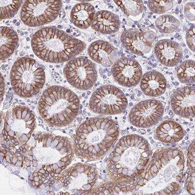 Immunohistochemistry-Paraffin: OR51M1 Antibody [NBP2-31649]