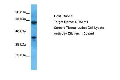 Western Blot: OR51M1 Antibody [NBP2-83323]