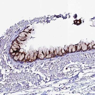 Immunohistochemistry-Paraffin: OR51Q1 Antibody [NBP1-86536]