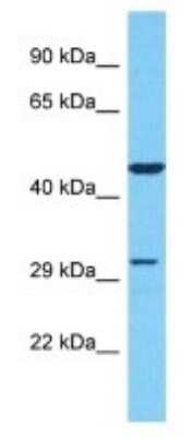 Western Blot: OR51S1 Antibody [NBP3-09864]