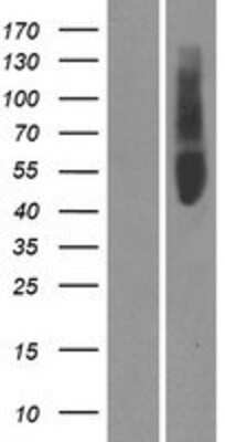 Western Blot: OR51V1 Overexpression Lysate [NBP2-08908]