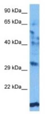 Western Blot: OR52A1 Antibody [NBP3-09999]