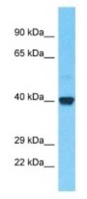 Western Blot: OR52B2 Antibody [NBP3-09865]