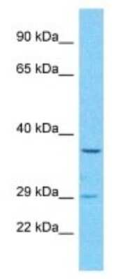 Western Blot: OR52B6 Antibody [NBP3-09866]