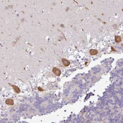 Immunohistochemistry: OR52D1 Antibody [NBP2-48862]