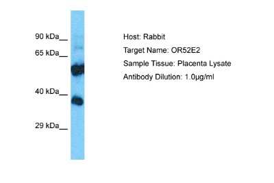 Western Blot: OR52E2 Antibody [NBP2-83325]