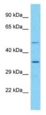 Western Blot: OR52E6 Antibody [NBP3-09867]