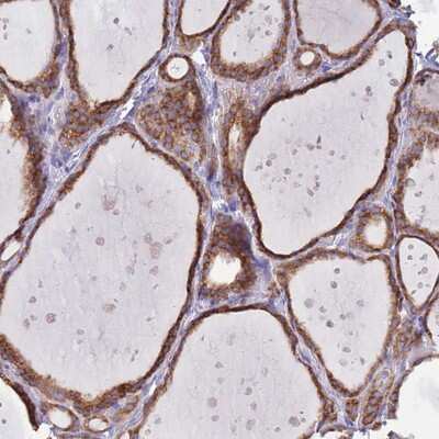 Immunohistochemistry-Paraffin: OR52I2 Antibody [NBP2-13704]