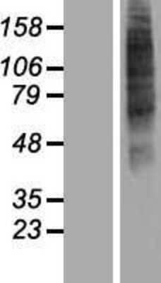 Western Blot: OR52I2 Overexpression Lysate [NBP2-08911]