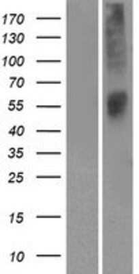 Western Blot: OR52L1 Overexpression Lysate [NBP2-08912]