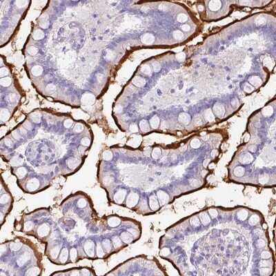 Immunohistochemistry: OR52N1 Antibody [NBP2-49110]