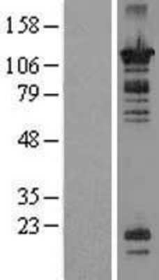 Western Blot: OR52N1 Overexpression Lysate [NBP2-08964]