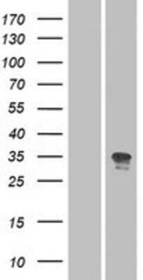 Western Blot: OR52N2 Overexpression Lysate [NBP2-08913]