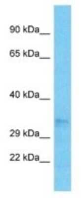 Western Blot: OR52N5 Antibody [NBP3-09868]