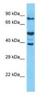 Western Blot: OR52W1 Antibody [NBP3-09870]