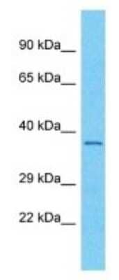 Western Blot: OR56A3 Antibody [NBP3-09871]