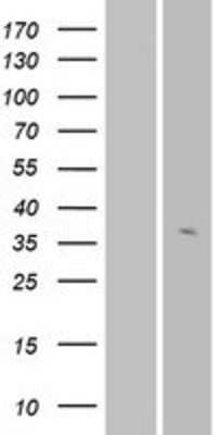 Western Blot: OR56A3 Overexpression Lysate [NBP2-08939]