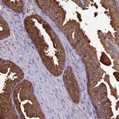 Immunohistochemistry-Paraffin: OR56B1 Antibody [NBP1-82477]