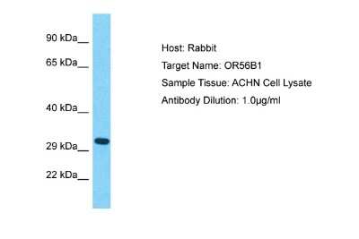 Western Blot: OR56B1 Antibody [NBP2-83328]